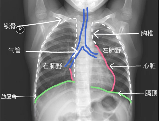 3cc22da1b876251b8bc21f63bc4ee68c.png