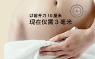 超導可視無痛人流手術(shù)步驟